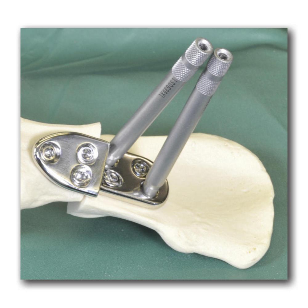 Bohrlehre für 3,5 mm Lockingschrauben extra lang(LSDG35XL)
